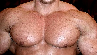 bodybuilder-stretch-marks.jpg